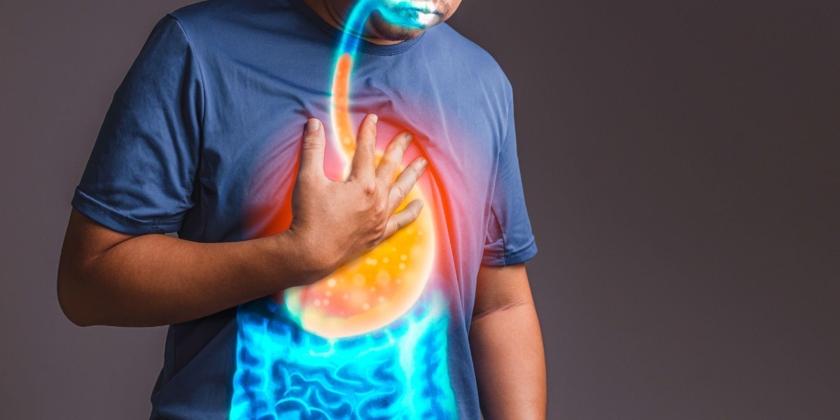 reflü hastalığı ve tedavi yöntemleri