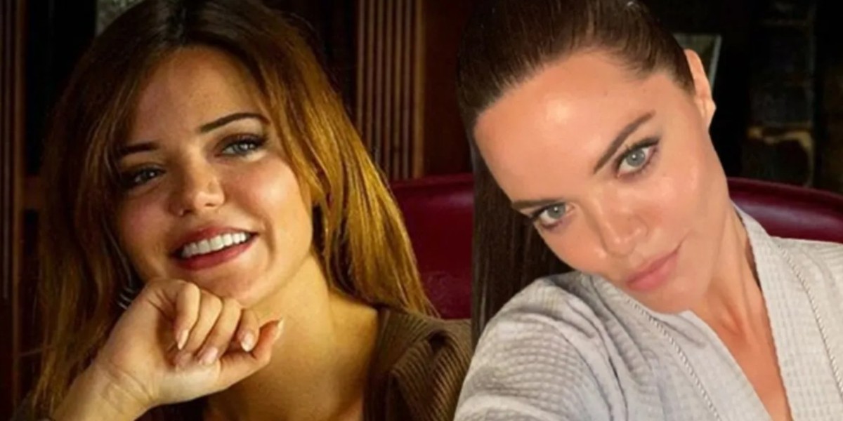 Hilal Altınbilek estetik